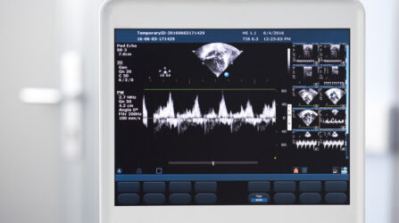 Echocardiography